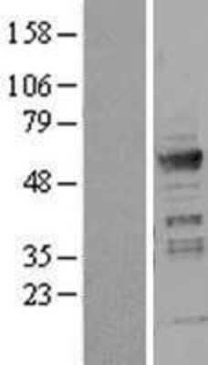 Western Blot: ICA1 Overexpression Lysate [NBL1-11801]