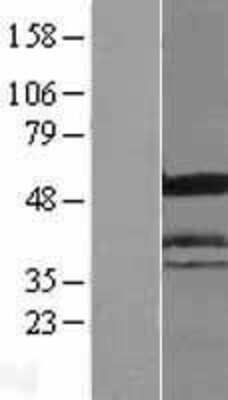 Western Blot: ICA1 Overexpression Lysate [NBL1-11802]