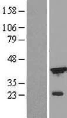 Western Blot: DFF45/ICAD Overexpression Lysate [NBL1-09842]