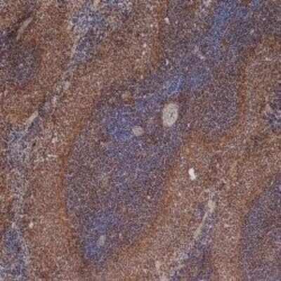 Immunohistochemistry-Frozen: ICAM-1/CD54 Antibody (1A29) [NBP2-22541]