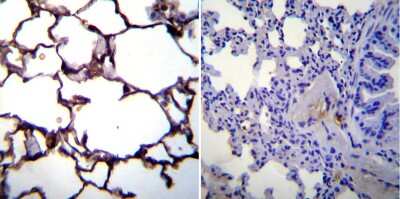 Immunohistochemistry: ICAM-1/CD54 Antibody (1A29) [NBP2-22541]