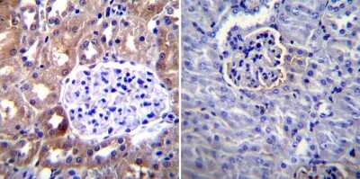 Immunohistochemistry-Paraffin: ICAM-1/CD54 Antibody (1A29) [NBP2-22541]