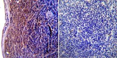 Immunohistochemistry-Paraffin: ICAM-1/CD54 Antibody (1A29) [NBP2-22541]