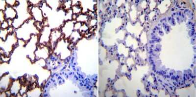 Immunohistochemistry-Paraffin: ICAM-1/CD54 Antibody (3E2B) - Azide and BSA Free [NBP2-22540]