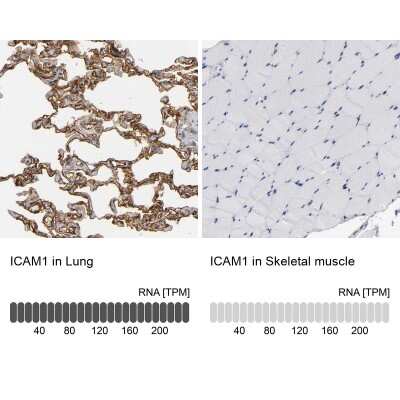 Immunohistochemistry-Paraffin: ICAM-1/CD54 Antibody [NBP1-88700]