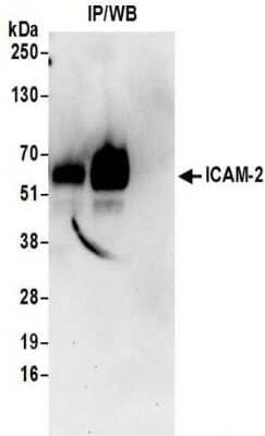 Immunoprecipitation: ICAM-2/CD102 Antibody [NBP2-32237]