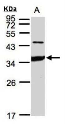 Western Blot: ICAM-2/CD102 Antibody [NBP1-31612]