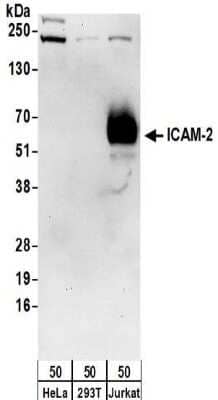 Western Blot: ICAM-2/CD102 Antibody [NBP2-32236]