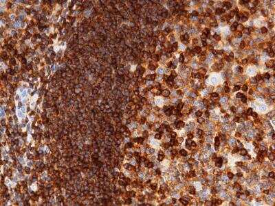 Immunohistochemistry-Paraffin: ICAM-3/CD50 Antibody (002) [NBP2-89426]