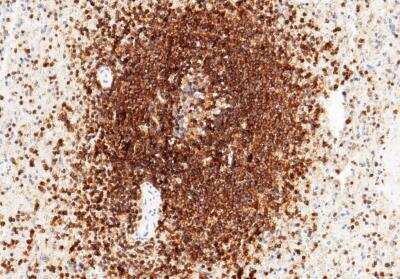 Immunohistochemistry-Paraffin: ICAM-3/CD50 Antibody (002) [NBP2-89426]