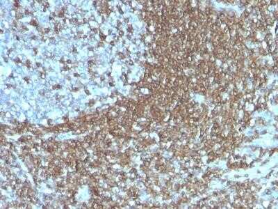 Immunohistochemistry-Paraffin: ICAM-3/CD50 Antibody (186-2G9) - Azide and BSA Free [NBP2-34521]