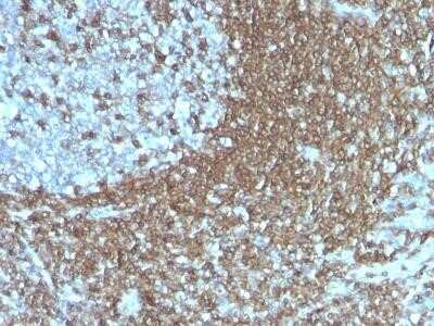 Immunohistochemistry-Paraffin: ICAM-3/CD50 Antibody (186-2G9) - IHC-Prediluted [NBP2-44547]