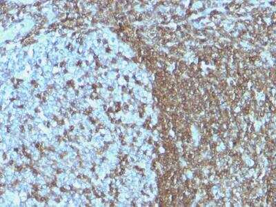 Immunohistochemistry-Paraffin: ICAM-3/CD50 Antibody (ICAM3/1019) - IHC-Prediluted [NBP2-48227]