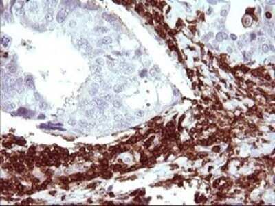 Immunohistochemistry: ICAM-3/CD50 Antibody (OTI1E7) - Azide and BSA Free [NBP2-70975]