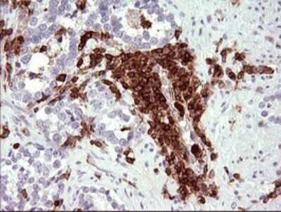 Immunohistochemistry: ICAM-3/CD50 Antibody (OTI1E7) - Azide and BSA Free [NBP2-70975]