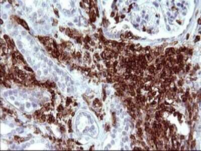 Immunohistochemistry: ICAM-3/CD50 Antibody (OTI1E7) [NBP2-46010]