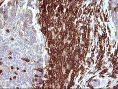 Immunohistochemistry: ICAM-3/CD50 Antibody (OTI1E7) [NBP2-46010]