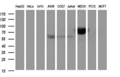 Western Blot: ICAM-3/CD50 Antibody (OTI1E7) [NBP2-46010]