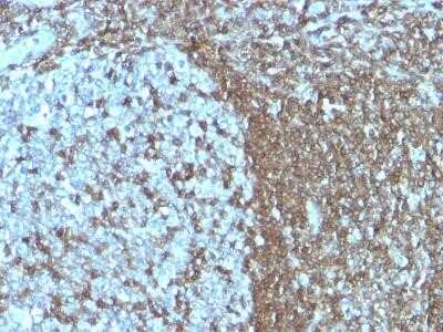 Immunohistochemistry-Paraffin: ICAM-3/CD50 Antibody (SPM505) - Azide and BSA Free [NBP2-34776]