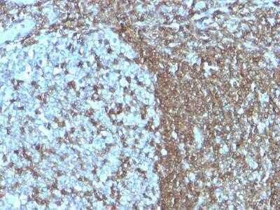 Immunohistochemistry-Paraffin: ICAM-3/CD50 Antibody (SPM505) - IHC-Prediluted [NBP2-44548]