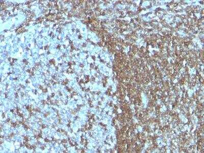 Immunohistochemistry-Paraffin: ICAM-3/CD50 Antibody (SPM505) [NBP2-32826]