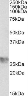 Western Blot: ICAM-4 Antibody [NBP2-26177]