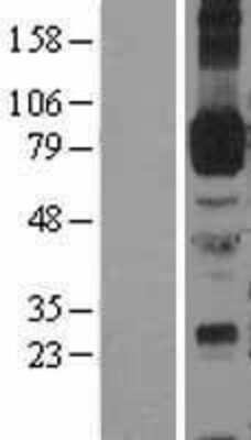 Western Blot: ICAM-1/CD54 Overexpression Lysate [NBL1-11804]