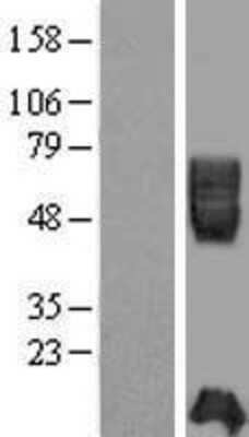 Western Blot: ICAM-2/CD102 Overexpression Lysate [NBP2-08994]