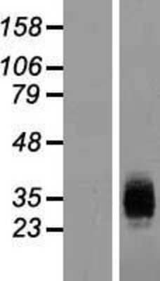 Western Blot: ICAM-4 Overexpression Lysate [NBL1-11807]