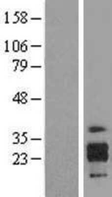 Western Blot: ICAM-4 Overexpression Lysate [NBL1-11808]