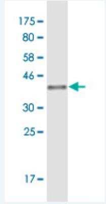 Western Blot: ICAP-1 Antibody (1E7) [H00009270-M08]