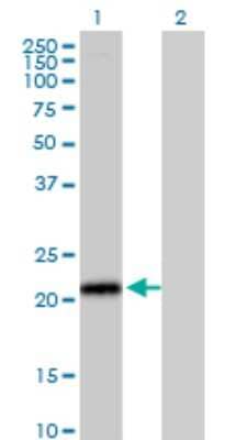 Western Blot: ICAP-1 Antibody (3B2) [H00009270-M09]