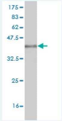 Western Blot: ICAP-1 Antibody (3G4) [H00009270-M04]