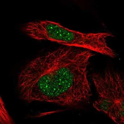 Immunocytochemistry/ Immunofluorescence: ICAP-1 Antibody [NBP2-68856]