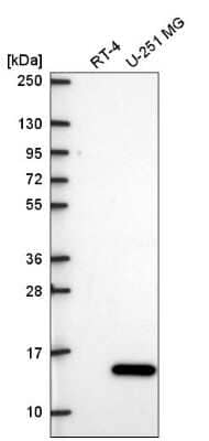 Western Blot: ICAP-1 Antibody [NBP2-57261]