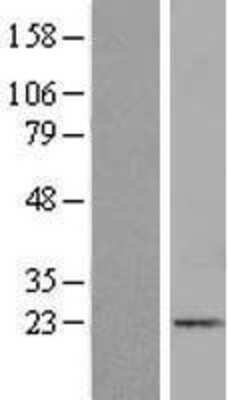 Western Blot: ICAP-1 Overexpression Lysate [NBL1-12071]