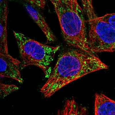 Immunocytochemistry/ Immunofluorescence: ICAT/CTNNBIP1 Antibody [NBP2-59020]