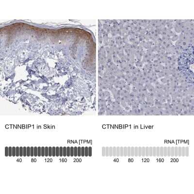 Immunocytochemistry/ Immunofluorescence: ICAT/CTNNBIP1 Antibody [NBP3-17057]