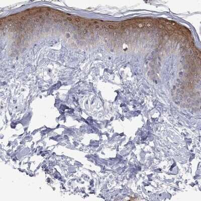 Immunohistochemistry-Paraffin: ICAT/CTNNBIP1 Antibody [NBP3-17057]