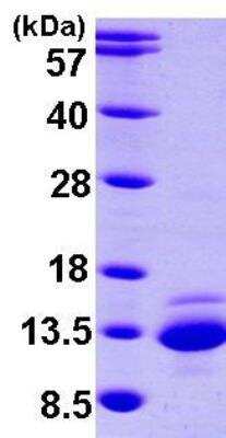 SDS-PAGE: Recombinant Human ICAT/CTNNBIP1 His Protein [NBP1-45266]