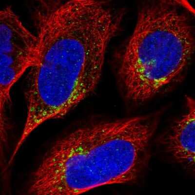 Immunocytochemistry/ Immunofluorescence: ICB1 Antibody [NBP1-87849]
