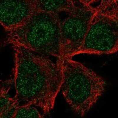 Immunocytochemistry/ Immunofluorescence: ICB1 Antibody [NBP3-17264]