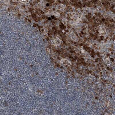 Immunohistochemistry-Paraffin: ICB1 Antibody [NBP1-87848]