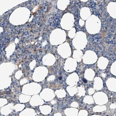 Immunohistochemistry-Paraffin: ICB1 Antibody [NBP1-87849]