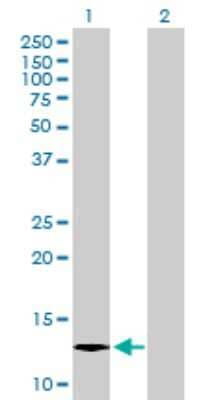 Western Blot: ICB1 Antibody [H00009473-B01P]