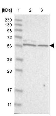 Western Blot: ICB1 Antibody [NBP1-87849]