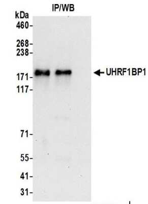 Immunoprecipitation: ICBP90 Binding Protein 1 Antibody [NBP2-37702]