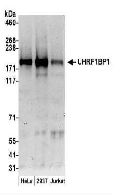 Western Blot: ICBP90 Binding Protein 1 Antibody [NBP2-37702]