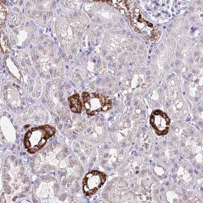 Immunohistochemistry: ICEBERG Antibody [NBP2-48688]