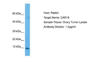 Western Blot: ICEBERG Antibody [NBP2-85088]